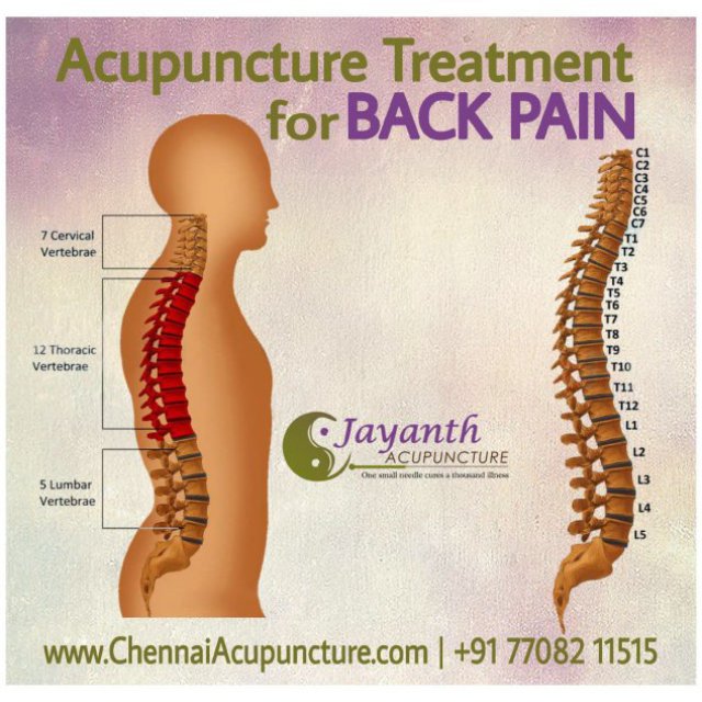 Chennai Jayanth Acupuncture - Acupuncture and Cupping Therapy