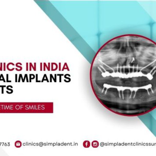 Full Mouth Dental Implant in Surat - Full Mouth Dental Implants Surgery