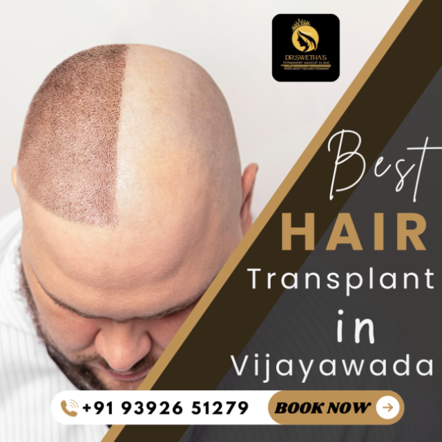 Dr.Swetha's Hair & Skin Clinic-hair transplant vijayawada