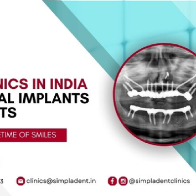 Flapless Zygomatic Implants - Flapless Pterygoid Implants Surgeon India