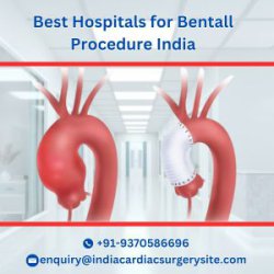 low cost bentall treatment India