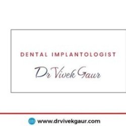 Tooth Implant in Delhi - Full Mouth Dental Implant Cost